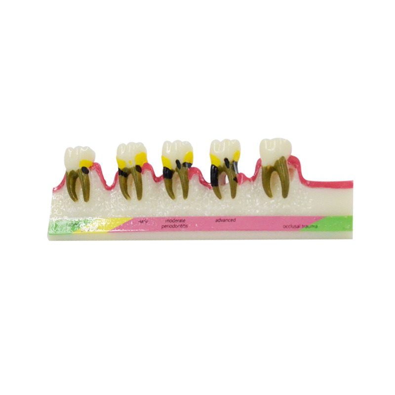 Medical Lab Study - Model penyakit storpelacak, bahan Dental Lab