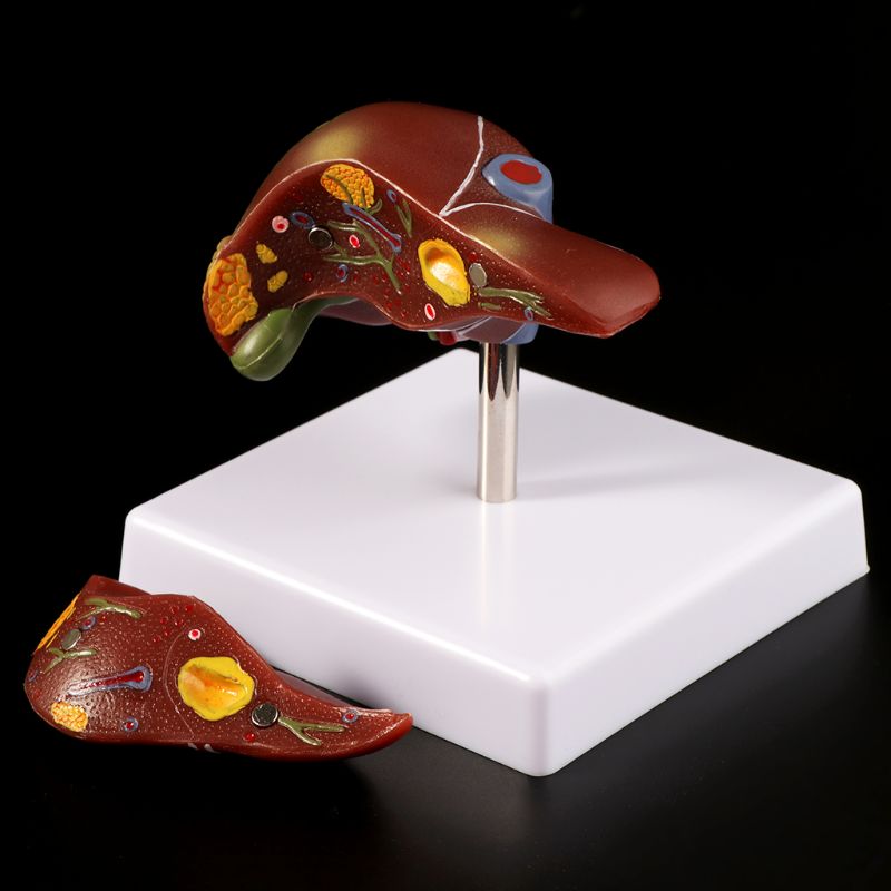 Medical Lab Design - Hati Manusia Patologis Anatomi Model Anatomi
