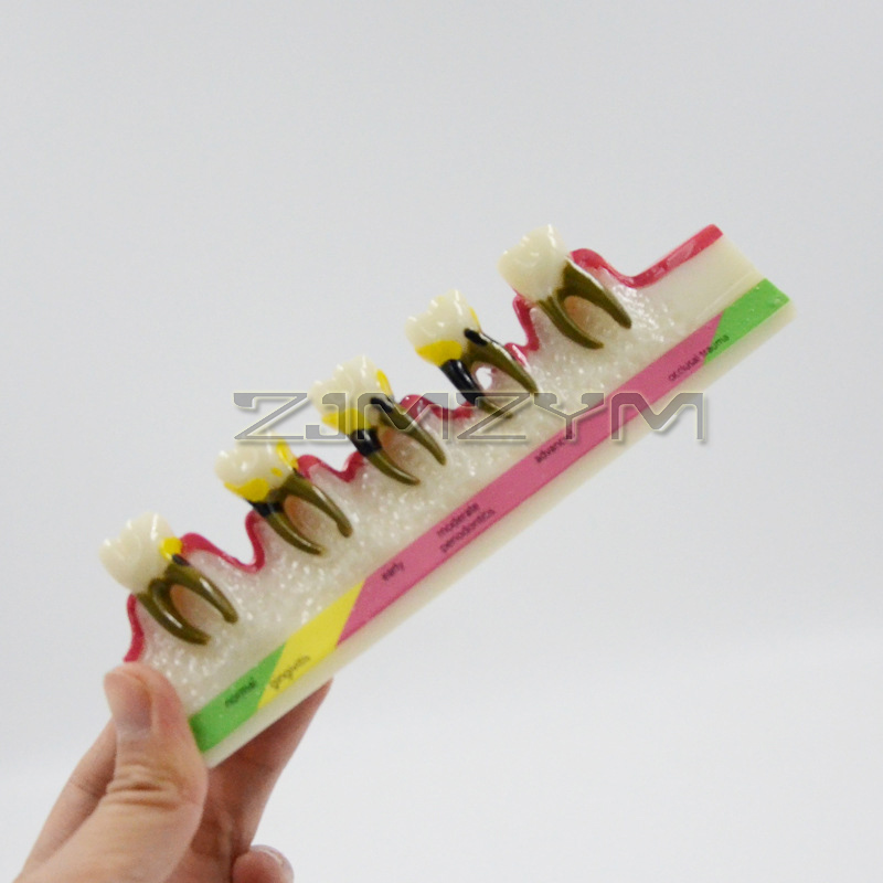 Model penyakit storpelacak, ba - Medical Lab Study ulasan dan harga
